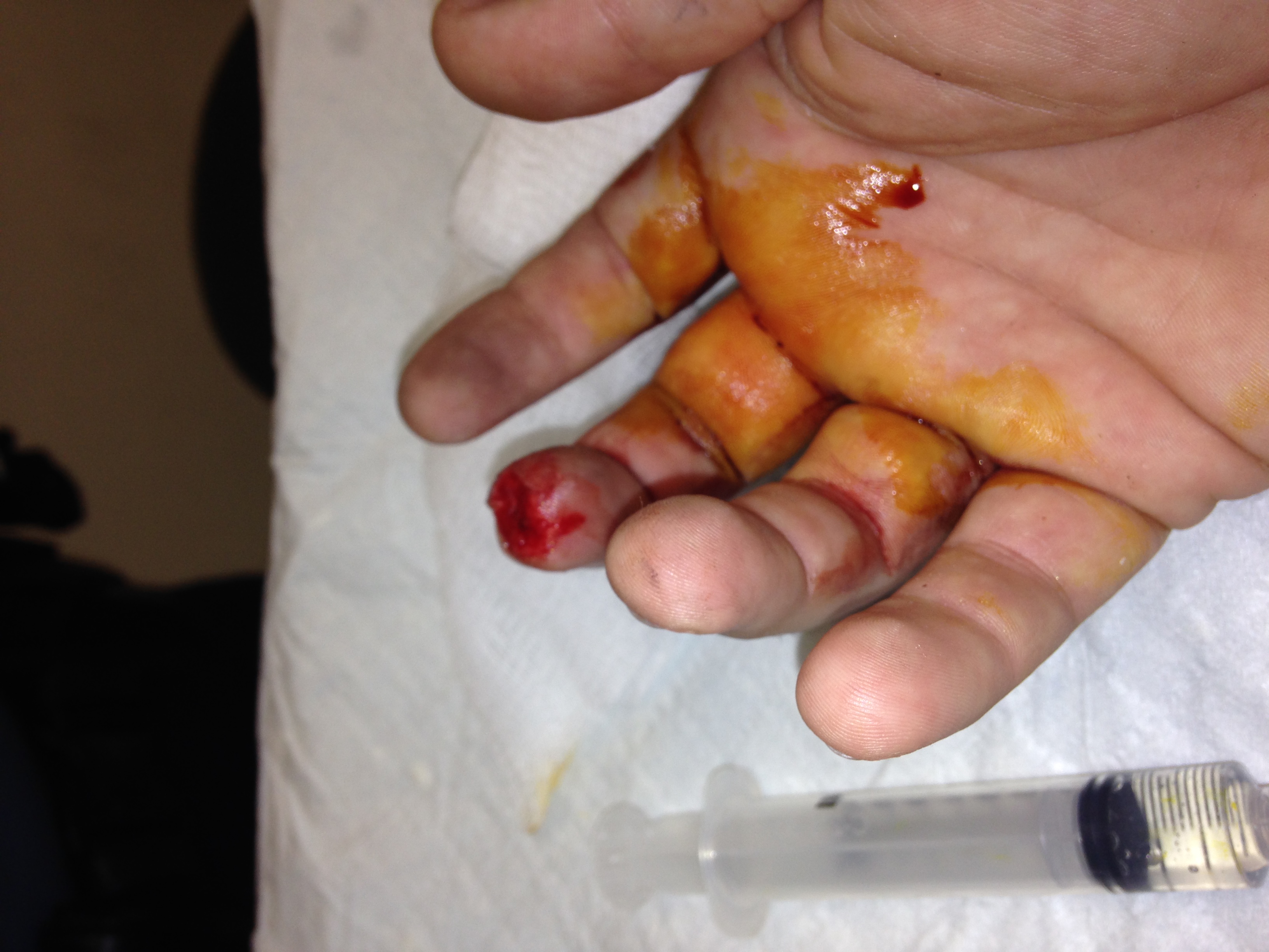 Maintenance Lesson #1: Do Not Rush